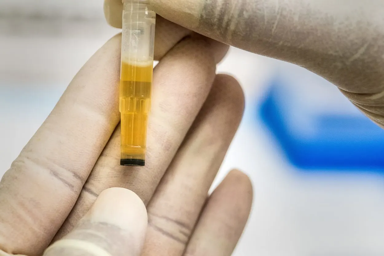  Het verschil tussen echte en synthetische urine - Alle verschillen